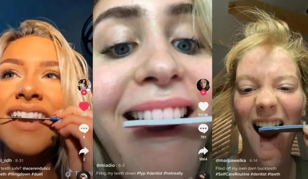 Se limer les dents : une tendance dangereuse sur TikTok