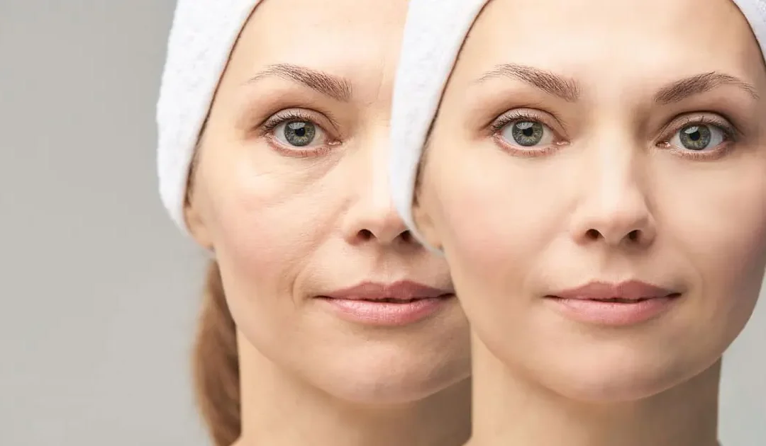 2 Traitements de rajeunissement du visage sans contraintes